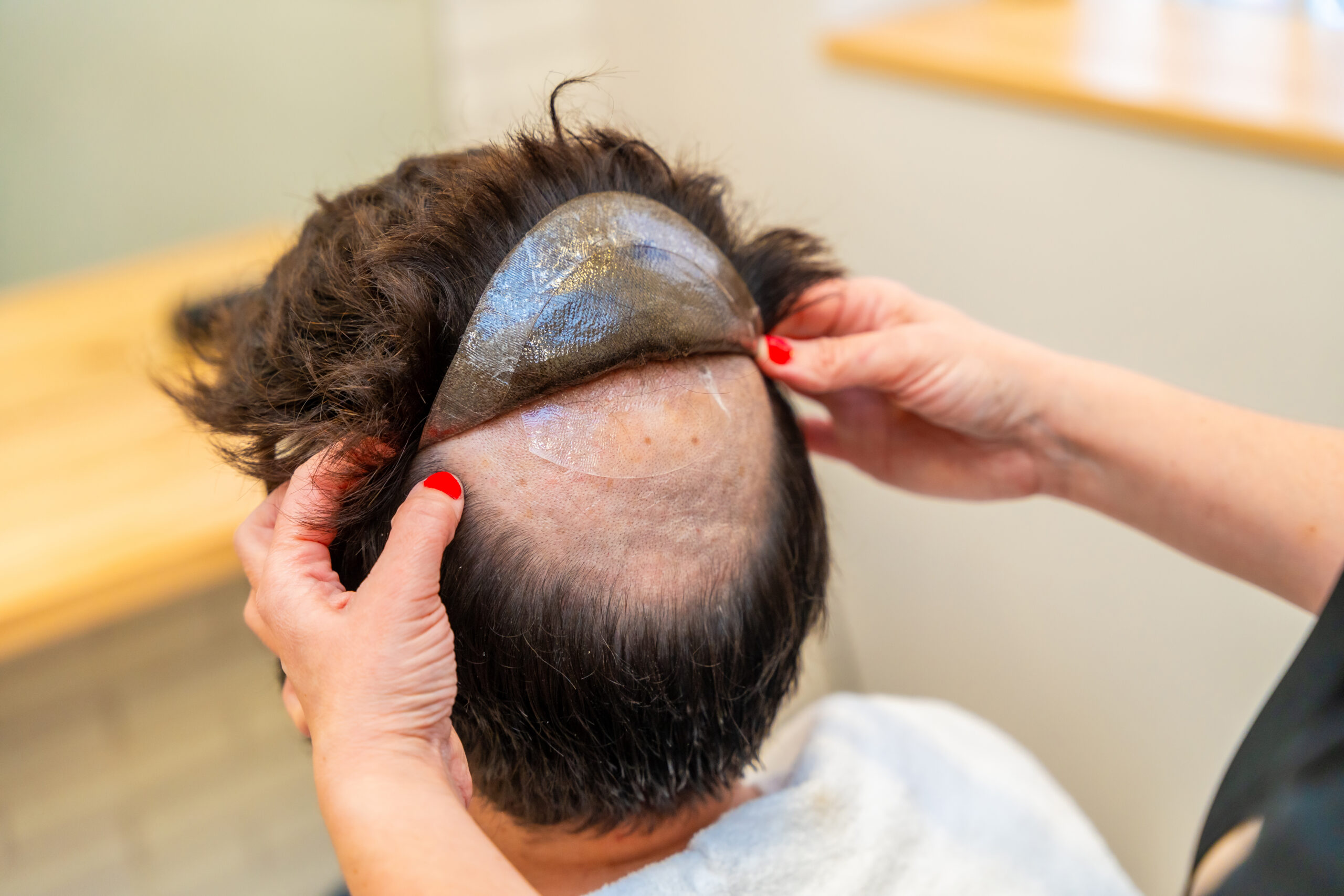 impianti-capelli